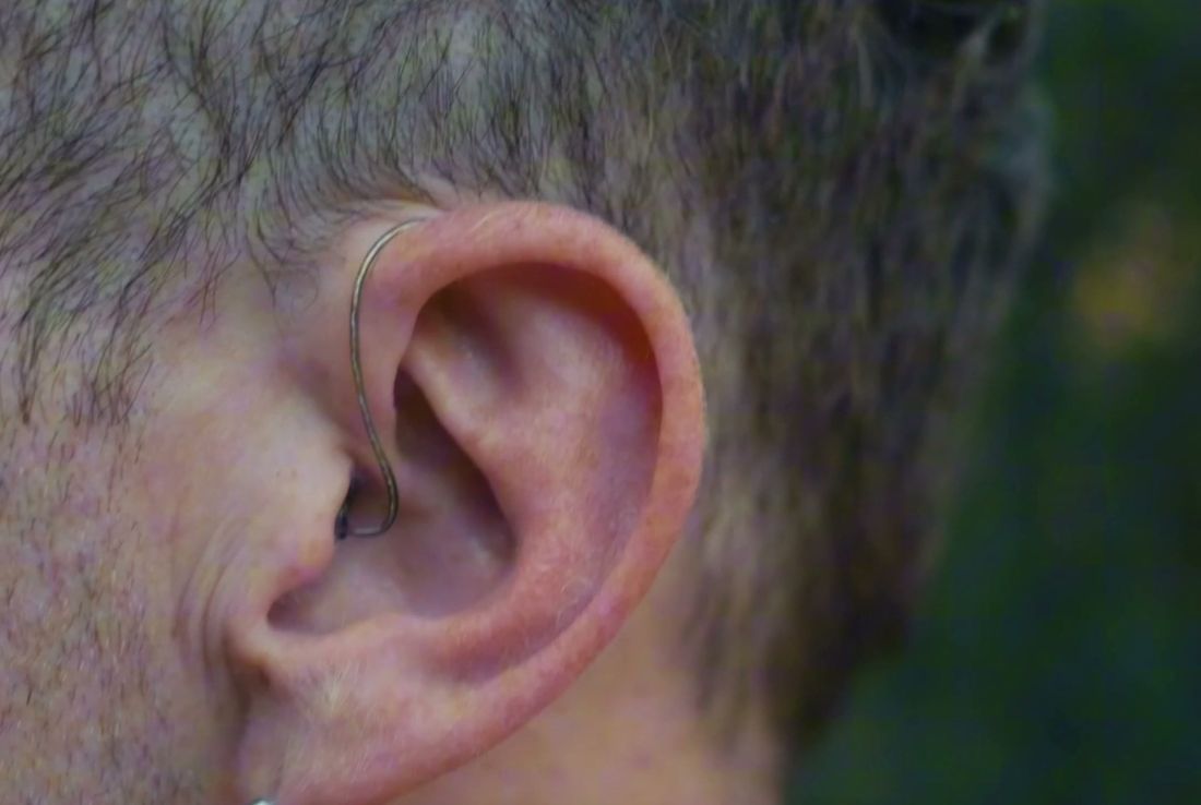 A Clarion hearing aid worn behind the ear, with only a thin clear tube showing